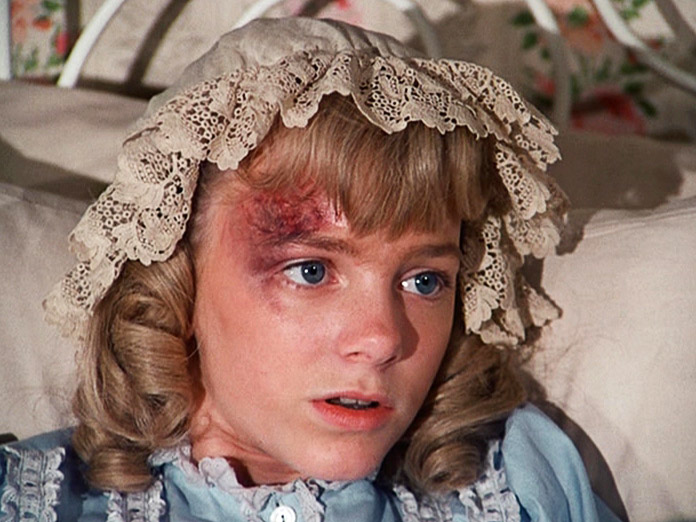 Nellie Oleson - but how injured is she really?